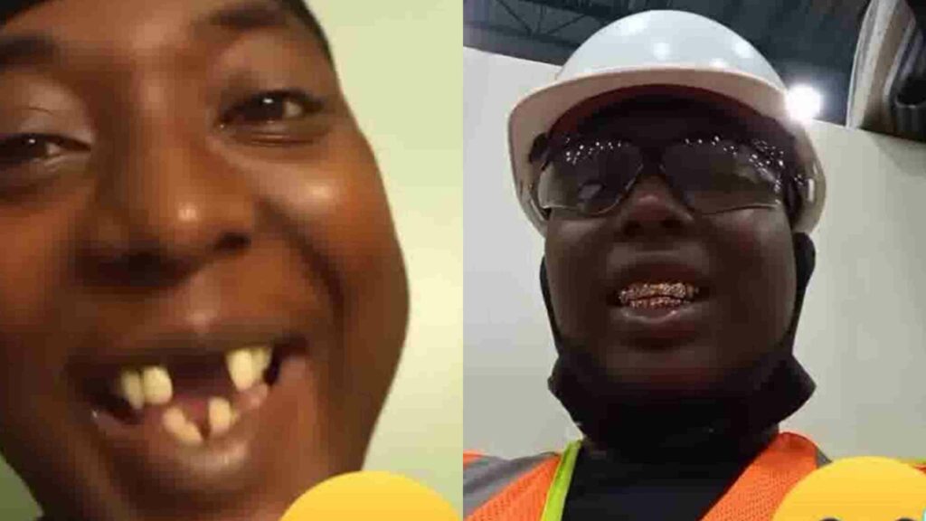 Man Displays New Grills In His Mouth