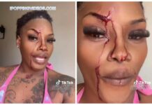 Pregnant Chick Hops on Live With Her Face Leaking, Swears She Took a Pipe to the Dome in a Scrap